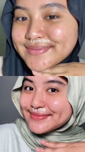 SKINTIFIC 5% Panthenol Acne Calming Water Gel 45g Pelembab Wajah Cream jerawat