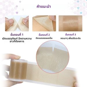 แผ่นซิลิโคนลดรอยแผลเป็น 1 ม้วน ทรีทเมนต์ลดรอยแผลเป็นจากการผ่าตัด แผลผ่าคลอด แผ่นแปะลดรอยแตกลาย