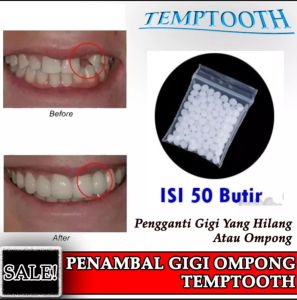 [Isi 50 Butir] Penambal Gigi Berlubang - Penambal Gigi Depan - Penambal Gigi Permanen - Temptooth Bahan Gigi Palsu Ori Penambal Penutup Gigi Ompong Gigi Palsu Penutup Ompong Dewasa Anak Gigi Palsu Murah