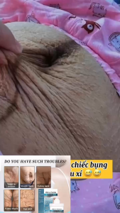 Set 3 Hộp Kem Dưỡng Da Chống Nhăn Làm Săn Chắc Da Giảm Chảy Xệ Phục Hồi Độ Đàn Hồi Và Trẻ Hóa Làn Da Tự Nhiên