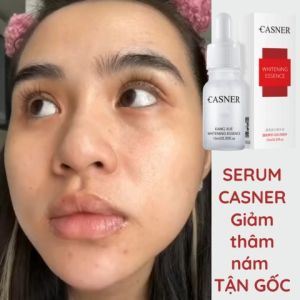 [ CHÍNH HÃNG] Serum CASNER Abutin TRẮNG DA GIẢM THÂM NÁM làm sáng bật tone da kiềm dầu dưỡng ẩm phù hợp với mọi loại da