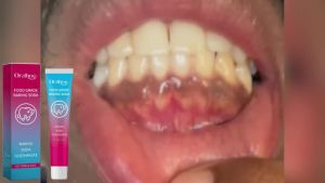 Oralhoe 100G Baking Soda Toothpaste Remove Yellow Teeth Stains Bleach Teeth Freshen Breath Deep Clean Daily Dental Care