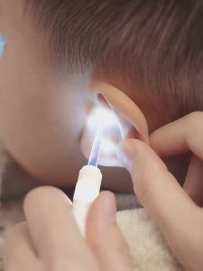 Alat Korek Telinga Kanak Kanak Dengan Lampu Boleh Nampak Earwax Set Penjagaan Telinga Selamat Untuk Bayi Baby Ear Digging Ear Scoop With Light Luminescent Ear Picking Buckle Visible Earwax 掏耳挖耳勺带灯宝宝儿童发光采耳掏耳朵淘扣工具套装可视耳屎 H214