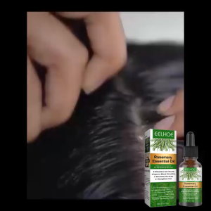 Eelhoe Rosemary Hair Serum for Hair Growth Anti Thinning Hair Loss Oil 30g