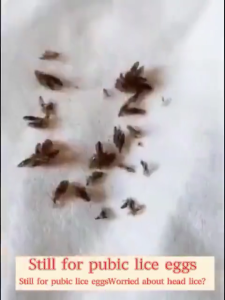 Shampo Kutu Rambut Anak dan Dewasa shampo 120ml anti kutu bio herbal shampo kutu rambut kutu kepala rambut alami shampo penghilang kutu rambut Obat kutu