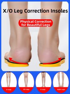 jzule | XO Leg Correction Arch Support Inserts