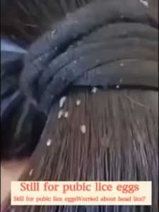 Head Lice Remover Shampoo Head Lice And Nits Anti Head Lice Removal Shampoo For Kids Adults Baby With Shower Cap And Comb Quickly Kills Head Lice Pubic Lice Larvae And Lice Eggs Anti Dandruff Shampoo Oil Control Anti-Dandruff Repair Damage Shampoo