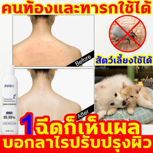 อย่ารอสร้างการสุขภาพของคุณได้ให้ดียิ่งขึ้นด้วย สเปรย์กำจัดไรฝุ่น 300 มล สเปรย์ละเอียด และสเปรย์การสัมผัส สำหรับแม่ลูก การฟื้นฟูกำจัดไรฝู่ การผลิตสีดำ และสมัครสีดำ