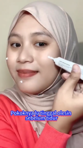 Cream Flek Hitam Membandel BPOM 20g Whiten & anti-freckle Whitening Cream Membandel Niacinamide cream Siang Malam salep flek hitam Whitening Freckle Cream Perbaikan bekas luka Niacin Dark Spots Removal Brightening