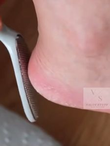 Durable Foot Callus Remover Scrubber Pedicure Tool Portable Exfoliator 2IN1 Function Safe To Use
