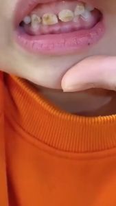 BABY U BRUSH SIKAT GIGI ANAK SIKAT SILIKON BENTUK U