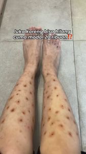 Solcare Light Booster Watermelon Body Serum