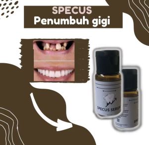 Cuci Gudang SPECUS Penumbuh Gigi 7 Hari Gigi Bolong Gigi Patah Gigi Keropos Dan Pemutih Gigi || Perawatan Gigi