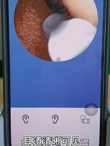 Visual Ear Cleaner Earpick With Light Ear Endoscope HD VIEW Earwax Ear Cleaner For Baby Adult Otoscope or Android/IOS