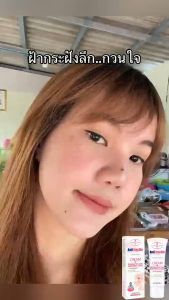 🌟Aichun🌟 ครีมฝ้ากระ ครีมบำรุงผิวหน้า ครีมหน้าใส ครีมสมุนไพร ช่วยลดเลือนฝ้า กระ จุดด่างดำ ผิวกระชับ ผิวชุ่มชื้น ฟื้นฟูผิวหมองคล้ำ เหมาะกับทุกสภาพผิว ขนาด 20 กรัม