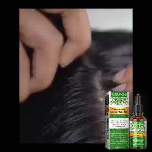【Buy 1 Take 1】 Eelhoe Rosemary Hair Care Essential Oil Improves Dryness And Frizz Hair Regrowth Solution For Men And Women 30ML
