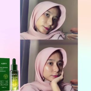 asid salisilik水杨酸Salicylic Acid Acne Removing essence Mildly eliminates acne shrinks pores removes acne marks 30ml repairs barrier and controls oil