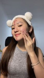 MS GLOW - Maxi Silk Peeling Serum Kulit Bejerawat 35ml