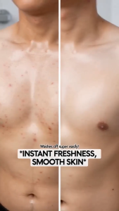 【BUY 2 TAKE 2】Mite Acne Antibacterial Cleansing Body Wash+ Handmade Perfume Gold Amino Acid Golden Soap Anti-Aging Mite Removal Cleansing Soothes Irritation Long Lasting Fragrance