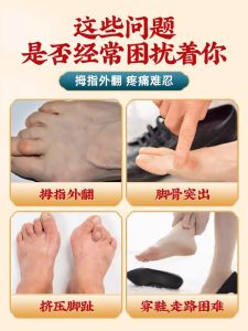 Womens Bunion Strips Large Foot Bone Correction Toe Deformity Orthosis Special Tool for Overlapping Mother Finger Care