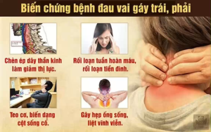 Đai Đeo Cổ Tự Nhiệt Emden100 Giảm Đau Mỏi Vai Gáy Hỗ Trợ Phục Hồi Chấn Thương Thoát Vị Đĩa Đệm Cổ Vải Sợi Carbon Từ Tính Cao Cấp
