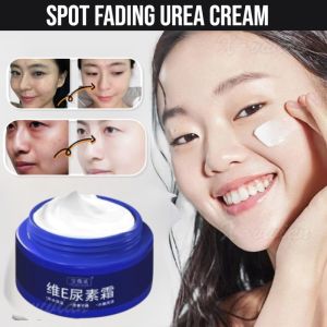 Spot Fading Urea Cream Whitening Freckle Remover Cream Dark Spots Remover Cream Melasma Removal Cream Moisturizer Brighten Skin