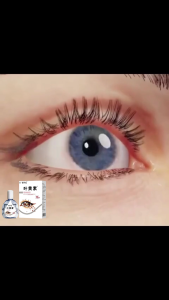 obat mata katarak Minus Mata Buram Katarak Mata 13ml Merah Mata Bengkak Mata Gatal Mata Bengkak Mata Gatal Mata Iritasi Glaukoma Vitamin Mata