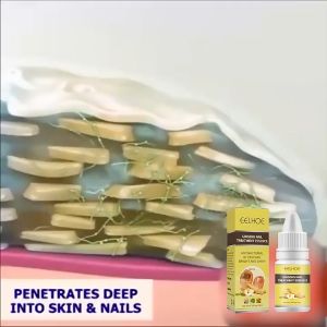 Effective Antifungal Serum Ginseng Nail Repair Serum Antifungal Nail Treatment Antifungal Nail Solution Hand and Foot Skin Care Anti Infective Paronychia Onychomycosis Serum 10ml