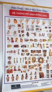 Combo 2 Cặp Tranh 68 Đồ Hình Đồng Ứng Và Tranh 32 Hình Phản Chiếu Các Huyệt Thường Dùng