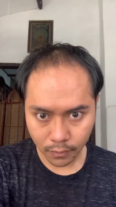 Ablution Shampo Herbal Anti Rontok + Parfum Raudhah Paket Perawatan Rambut dan Tubuh Pria Wanita | Wangi Tahan Lama & Rambut Sehat