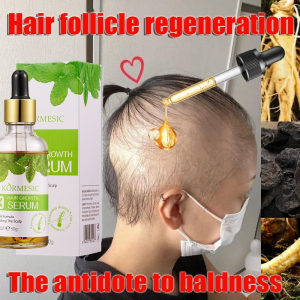 Serum Penumbuh Rambut Super Cepat: Solusi untuk Rambut Botak, Rontok, dan Rusak