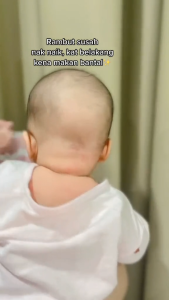 {READY STOCK } Youbaby Serum Serum lebat rambut bayi | Serum bayi viral | Serum rambut rosak | Serum Cradle Cap