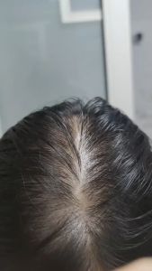 Sampo AHE: Perawatan Anti Rambut Rontok Kontrol Minyak Anti Ketombe