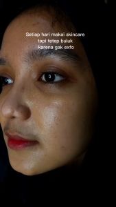 Cara Membuat Kulit Wajah yang Bersih dengan Perawatan Exfoliating Brightening Face dan DNA Salmon
