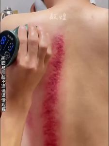 Thiết Bị Giác Hơi Điện Minhuang Thiết Bị Cạo Gió Bàn Chải Kinh Mạch Điện Thiết Bị Mát Xa Đa Năng Máy Hút Gió Gia Dụng Thiết Bị NẠO VÉT Gió