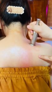 Chày Đồng Inox Giải Cơ - Lưu Thông Khí Huyết - Dụng Cụ Diện Chẩn