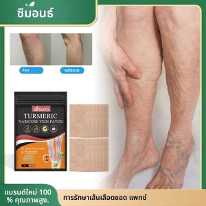 แผ่นแปะรักษาเส้นเลือดขอด บรรเทาอาการขาบวม ลดอาการอักเสบของหลอดเลือด ป้องกันโรคหลอดเลือดดำอักเสบ ฟื้นฟูขา ลดเส้นเลือดขอด