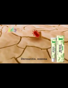 MiaoJia Zudaifu Skin Cream Ointment Moisturizer Skin Care Herbal Eczema 15g original Psoriasis Dermatitis Eczema