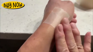 AKIRO HOME Malaysia Waterproof Grade Hydrocolloid Roll Tape 5M Acne Patch Scar Reducer DIY Wound Dressing Burn Blister Bandage Film Jerawat Pembalut Luka 痘痘贴防止疤痕