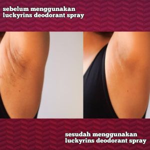 PEMUTIH KETIAK PENGHILANG FLEK HITAM DAN BAU BADAN