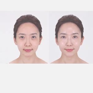 Medipeel Melanon X Cream 30ml - Brightening Dark Spot Remover for Face Whitening ，Suitable for all skin types | Black Spot Frost