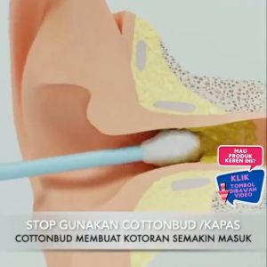 Pembersih Telinga Korek Kuping Ear Wax Picker 7 PCS / 7 in 1 / Pembersih telinga 1 set full Pembersih telinga led kamera Pembersih telinga kamera