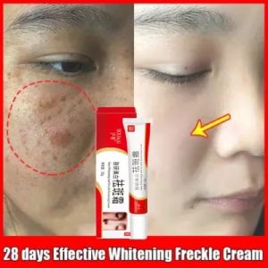 Krim Wajah 20g: Solusi Flek, Bekas Jerawat, Melasma & Penuaan