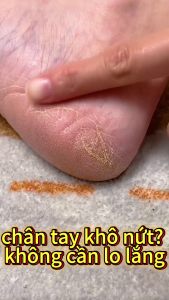 Kem bôi nứt gót chân dầu ngựa chính hãng LazMall thích hợp cho gót chân bàn tay nứt nẻ dưỡng ẩm cho da  giúp da luôn ẩm mềm mại 30g