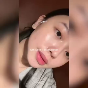 SKIN1004 Madagascar Centella Tone Brightening Capsule Ampoule 100ml Moisturizing and brightening gentle on sensitive skin