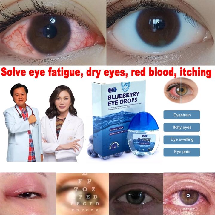 Original Blueberries Eye Drops for Clear Vision Dry Eyes Congestion ...