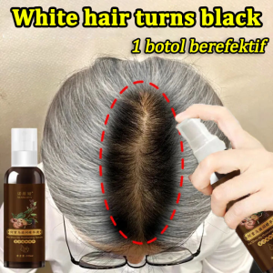 Hair Serum For Hair Growth 100ml Herbal Black Hair Spray Hair Anti Hair Loss And Hair Growth