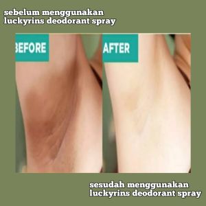 PEMUTIH KETIAK PEMBERSIH KETIAK PALING AMPUH