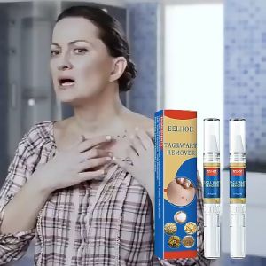 [Hoàn tiền 20%] [HCM]TAG&WART REMOVER Tẩy nốt ruồi Loại bỏ mụn ruồi trâumụn thịtmụn cócmụn cơm cứng đầu nhanh chóng lấy lại làn da tự tin căng đẹp- Bút Xóa Mụn Cóc Liệu3ML