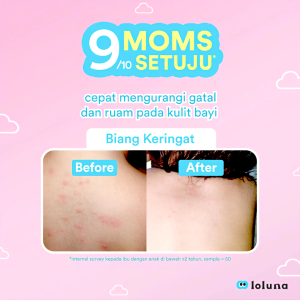 Loluna Cerapair Baby Rash Cream 30ml - Krim anti ruam iritasi dan gatal gigitan serangga untuk bayi dan anak